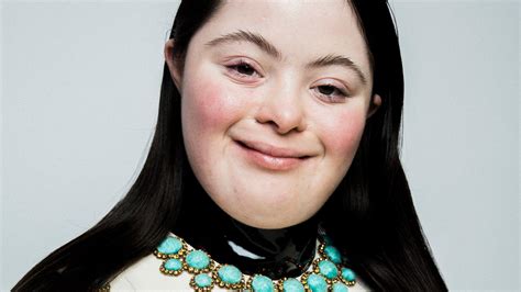 ellie goldstein model gucci|Gucci models with disability.